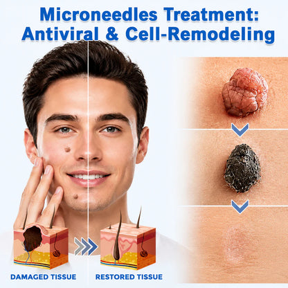 ✨Evroya®2-in-1 Microneedle & Hydrocolloid Patch🍀