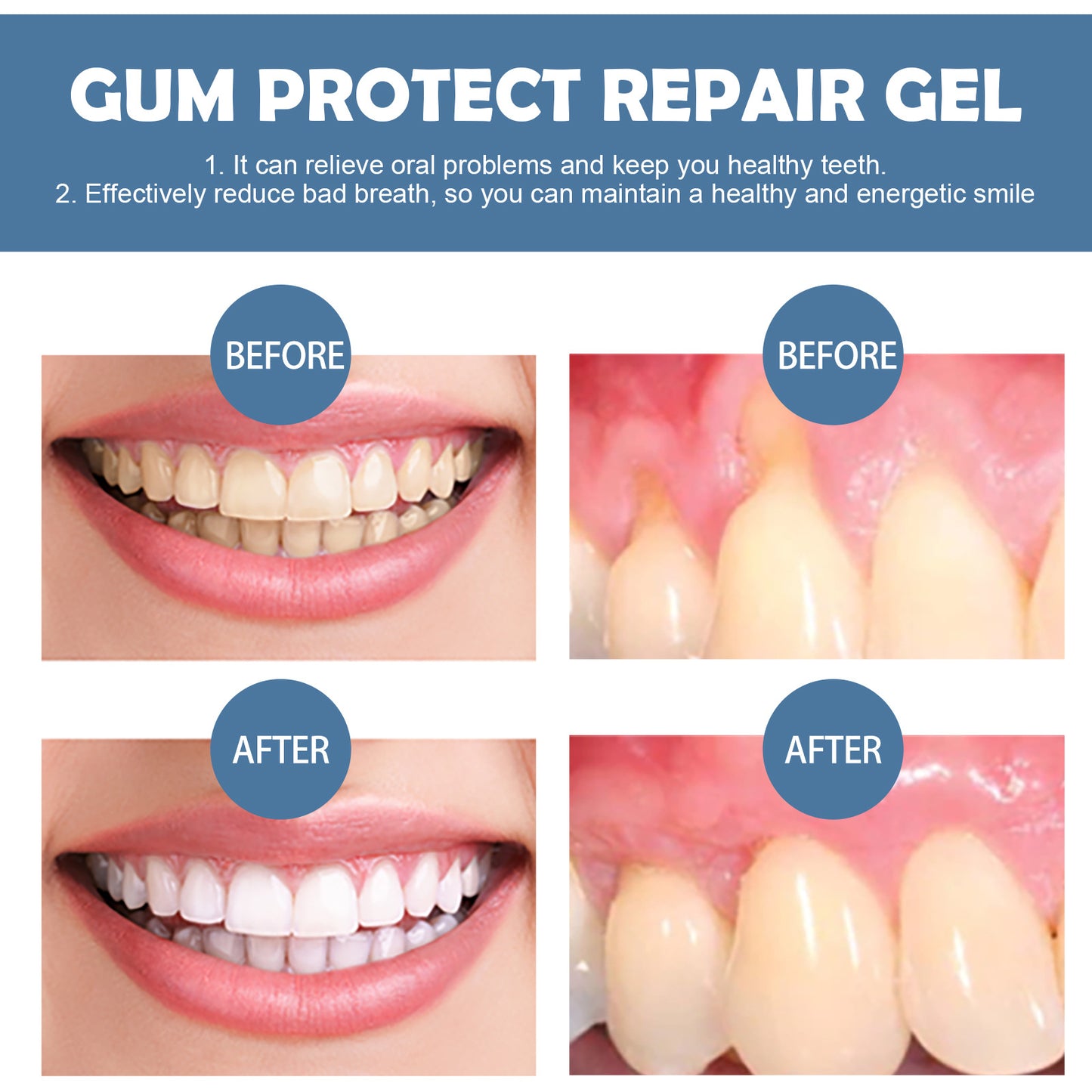 ⭐ 4.9/5 Stars | 10,000+ Happy Customers ⭐ Evroya®Gum Repair Gel – Visibly Removes Years of Stains, Heals Receding Gums & Gives You All-Day Fresh Breath