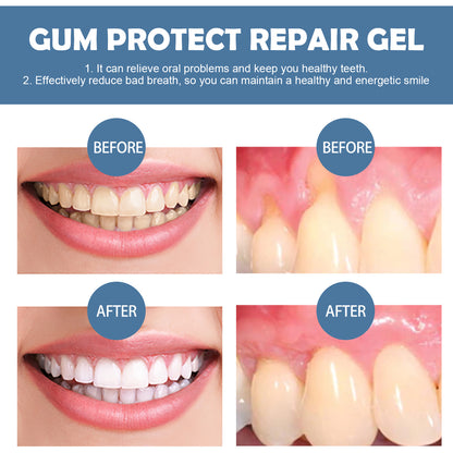 ⭐ 4.9/5 Stars | 10,000+ Happy Customers ⭐ Evroya®Gum Repair Gel – Visibly Removes Years of Stains, Heals Receding Gums & Gives You All-Day Fresh Breath